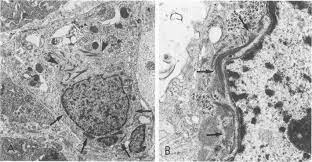 histology is a biology branch that includes the study of cells and tissues. Oa Electron Microscopy Of A Malignant Mesothelial Cell In Tissue From A Download Scientific Diagram