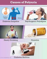 Image result for Polyuria