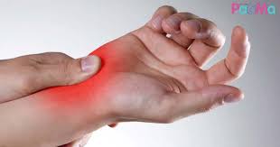 Setelah beberapa minit, kaki anda akan menjadi seperti biasa. Ibu Hamil Mudah Terkena Carpal Tunnel Syndrome Kebas Sakit Menyengat Jari Tangan Akibat Saraf Tertekan Pa Ma