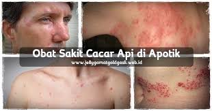 Pin Di Obat Herbal