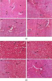 Image result for Hypericum roeperianum
