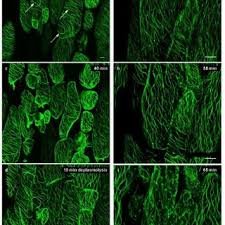 This is because plant cells have a rigid cell wall around the plasma membrane. Pdf Plasmolysis Loss Of Turgor And Beyond