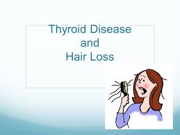 Periodically, i go through periods when i have shedding or hair loss, and that's when i start taking evening primrose oil daily. Thyroid Disease And Hair Loss Types Of Hair Loss Generalized Shedding More Hair In Drains On Brush No Specific Patches Of Loss Or Baldness Most Common Ppt Download
