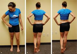 Image result for Hip Exam