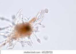 Image result for Pseudopod Ospermum