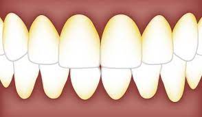 We did not find results for: How To Get Rid Off Tartar And Plaque Istanbul Dental Care