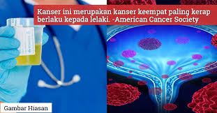 Pundi kencing akan memberi isyarat kepada otak untuk membuang air kecil sekiranya ia sudah penuh. Dikait Dengan Amalan Merokok Pakar Dedah Ujian Air Kencing Dapat Kesan Kanser Pundi Kencing 10 Tahun Lebih Awal