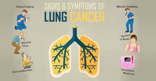 But in some cases, they may occur before that and actually be what tips you off that something is wrong. The Symptoms Of Lung Cancer In Males And Females