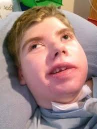 The Kobe Project for Shaken Baby Syndrome Awareness