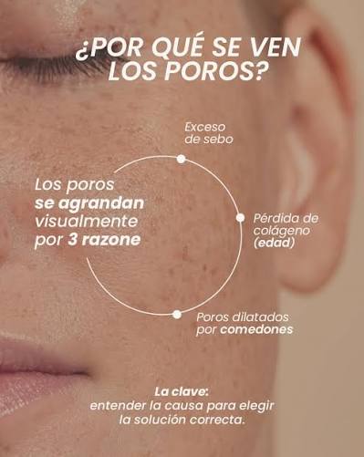Los poros no se “cierran”. Se tratan. Cuando hay exceso de sebo,  acumulación o pérdida de colágeno, se vuelven más visibles. Por eso las  soluciones rápidas no funcionan. La clave está en