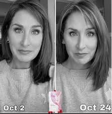 Is Biotin Effective for Hair, Skin, and Nail Health? A Scientific Review  #Biotin, #VitaminH, #VitaminB7, #Hairhealth, #Skinhealth, #NailHealth,  #HairGrowth, #Bloodsugarcontrol, #SupplementDeficiency, #Metabolism,  #Sciencebacked