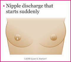 Warning Signs Of Breast Cancer | Susan G. Komen®