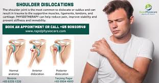Pin On Affordable Physiotherapy
