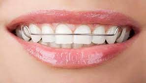 Treatment takes only two visits with no drilling and no. How To Fill Gaps Between Teeth Naturally At Home