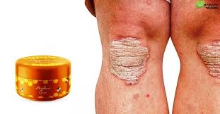 We did not find results for: Krem Medovyj Spas Ot Psoriaza Realnye Otzyvy Pokupatelej