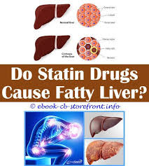 3 Cheerful Clever Ideas How Fatty Liver Can Be Cured Fatty Liver Grade 3 Means Natural Products On Nonalcoholic Fatty Liver Disease Mild Fatty Infiltration Of