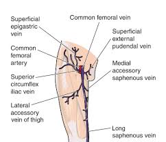 Groin muscles diagram diagram of groin aponeurosis from sscsantry groin project medical. Varicose Veins Leg Groin Right In Your Face