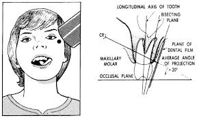 Dental Radiography