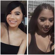 Do You Guys Think My Nose Is The Right Shape For A Septum Piercing If Not What Do You Guys Think Of A Nose Piercing Piercing