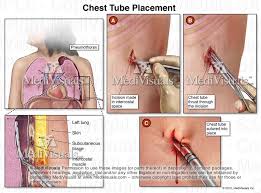 Pin On Medical