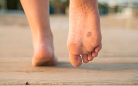 If detected in the early stages, foot cancer can be treated effectively. Skin Conditions Of The Feet