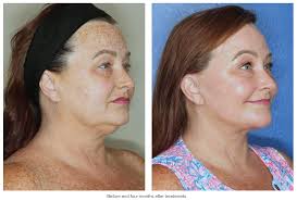 The Aesthetic Awards 2024: Celebrating Excellence in Aesthetics