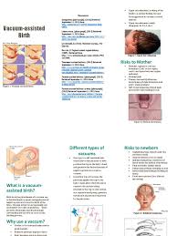 Image result for Vacuum Caput