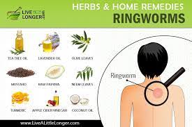 Tea tree oil may be applied to the affected area directly. Home Remedies For Ringworms Home Remedies For Ringworm Ringworm Remedies Home Remedy For Ringworm