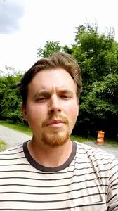 Chronic inflammatory demyelinating polyneuropathy (CIDP) is a rare  autoimmune disease that impacts the peripheral nervous system. Come along  to learn more about this rare disease and share the video ...