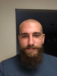 You should try it out! Long Hair Dreads Long Undercut Most Of My Life Been Receding For A Couple Years Not Playing The Game Full Send On The Baldy What Do We Think Bald