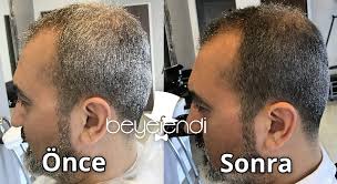 Beyaz Sac Icin Renk Kirma Islemi Nasil Yapilir Beyefendi