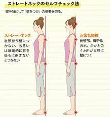 ストレートネックの治し方 首や肩の痛みは スマホ首 が原因だった 特選街web 肩 筋肉 ストレート ネック 頭痛 治し方