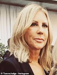 Kelly Dodd slams RHOC co-star Vicki Gunvalson's facelift as she says the  surgery 'malfunctioned'