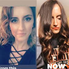 Why am I experiencing increased hair loss?