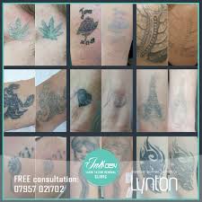 See reviews, photos, directions, phone numbers and more for free gang tattoo removal clinic locations in hawthorne, ca. Laser Tattoo Removal Tattoo Size Guide Unlike Other Clinics We Take Into Account The Size Shape Design And Density Of Each Tattoo To Give A Personalised And Accurate Price If Your Tattoo