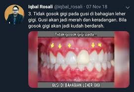 Badanku berbentuk pipih dan tajam. Pergigian Pusat Sejahtera Usm Posts Facebook