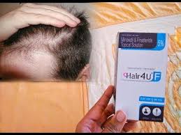 Frizzproof locks out frizz and creates an invisible, weightless shield over your hair. Hair Loss Treatment Hair 4u F Minoxidil Solution 100 Result By Unbeatable Products Youtube