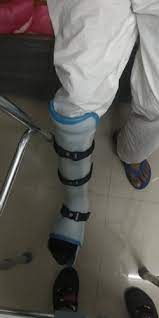 The wrist brace is made of high quality material and is designed to protect your hands from wear and tear, and can also be used for a variety of activities. Poly Proplene Hinged Braces Patella Tendon Bearing Brace Ptb For Clinical Id 22090726273