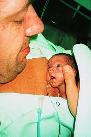Verwenden sie den chatbot, um ihre suche weiter zu verfeinern. Neonatologie Abstract Europe Pmc