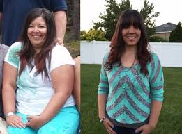 Pin On Before And After Sleeve Gastrectomy