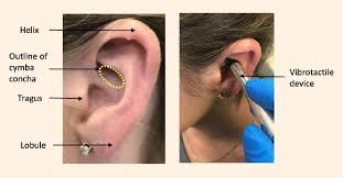 These nerves help control the speed and vasovagal syncope is quite common. Vagus Nerve Stimulation Via The Outer Ear Takes Center Stage Psychology Today