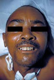 Translation of 'gigi' by kent from swedish to english. Datei Lock Jaw 2857 Jpg Wikipedia