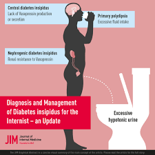 We did not find results for: Diagnosis And Management Of Diabetes Insipidus For The Internist An Update Christ Crain 2021 Journal Of Internal Medicine Wiley Online Library