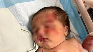 Bimba di due anni si perde nel bosco, la trovano che dorme abbracciata al  cane