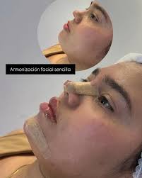 Reel by 𝐂𝐄𝐍𝐓𝐑𝐎 𝐄𝐒𝐓𝐄𝐓𝐈𝐂𝐎 𝐃𝐀𝐍𝐈𝐄𝐋𝐀 𝐕𝐈𝐋𝐋𝐀𝐃𝐀  (@centroestetico_danielavillada) · August 27, 2025