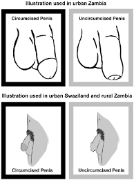 Illustrations of circumcised and uncircumcised penis.... | Download  Scientific Diagram
