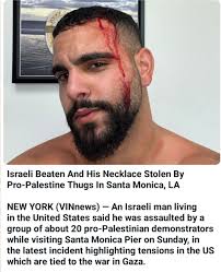 POLICE POLCEO О LICE ጠው Israeli Beaten And His Necklace Stolen By  Pro-Palestine Thugs Thugs In Santa Monica, LA NEW YORK (VINnews) -An