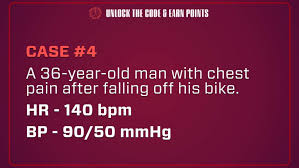 Image result for Shock Index