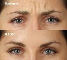 Epingle Sur Soins Naturels Astuces Beautes Remedes