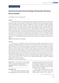 Askep sirosis hepatis bab ii tinjauan teori a. Pdf Gambaran Derajat Varises Esofagus Berdasarkan Beratnya Sirosis Hepatis